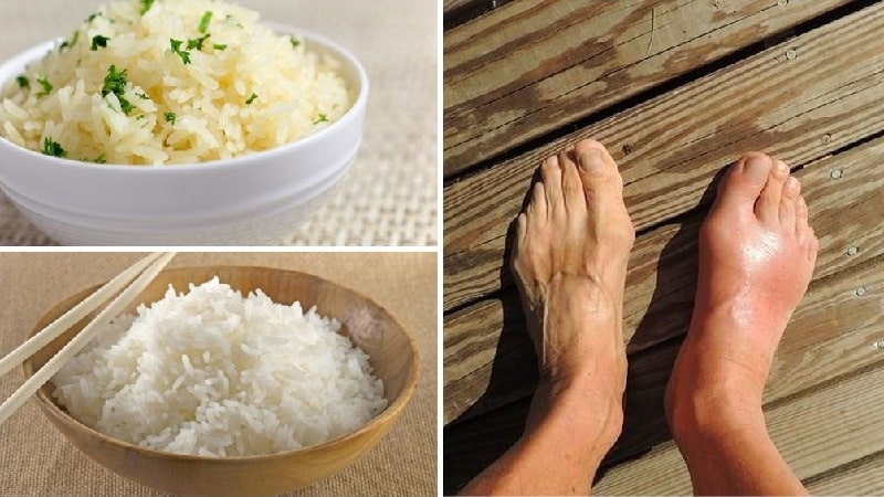 Is it possible to eat rice if you have gout: the benefits and possible harm of the product