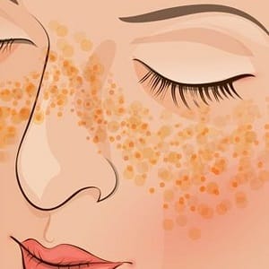 Mga recipe para sa paggawa ng mga homemade potato face mask laban sa mga wrinkles