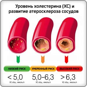 És possible menjar patates si tens colesterol alt?