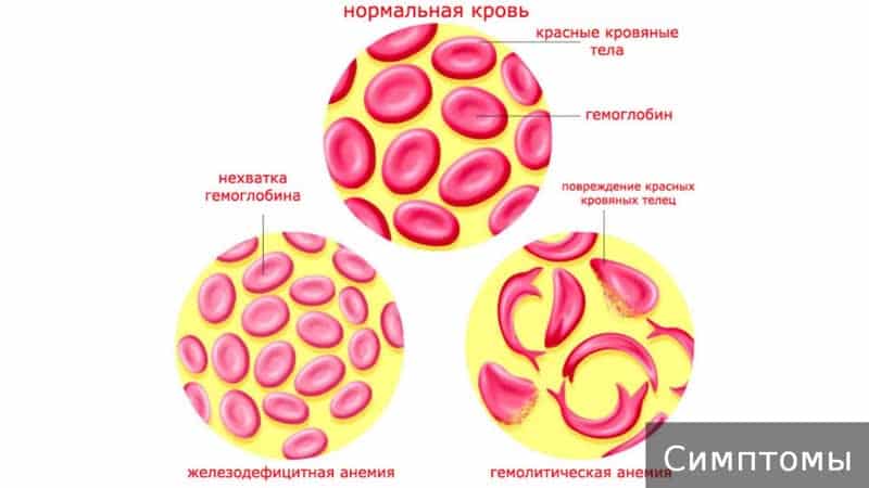 Mikä on alhaisen hemoglobiinin vaara ja miten tattari lisää sitä?