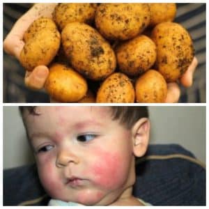 Nous abordons les questions de savoir pourquoi un enfant mange des pommes de terre crues et si cela est nocif