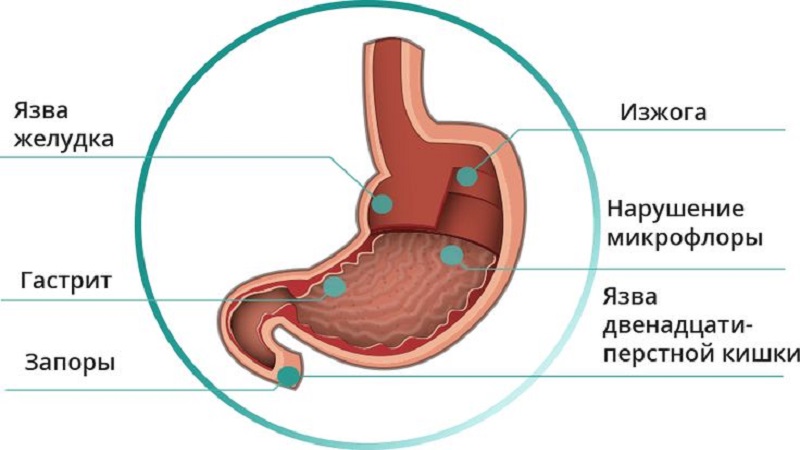 Buchweizen gegen Gastritis